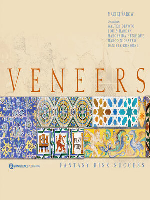 cover image of Veneers